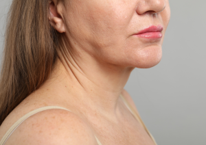 lifting facial