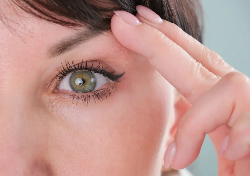 blefaroplastia
